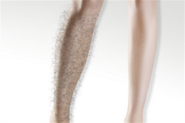 激光脫毛有哪些優(yōu)勢？激光脫毛的方式