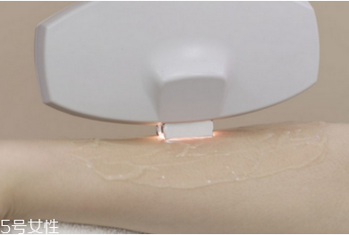 激光脫毛有哪些優(yōu)勢？激光脫毛的方式