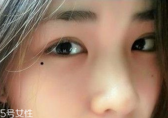 痣越多越長壽嗎？身上最有福氣的吉痣