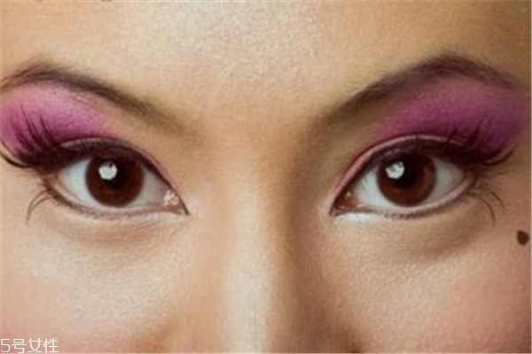 黑痣是怎么形成的？防范黑色毒瘤