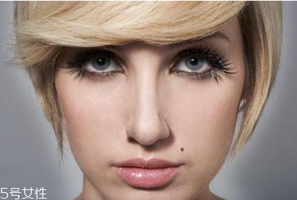 黑痣是怎么形成的？防范黑色毒瘤