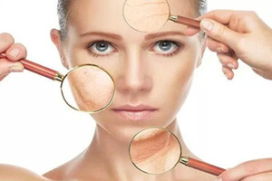 如何提高皮膚抗氧化能力？飲食運動相結合