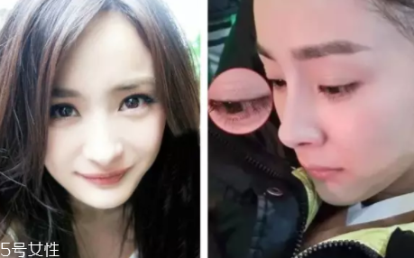 內雙怎么進化成雙眼皮？全是雙眼皮貼的功勞