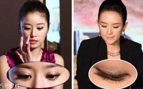 內雙怎么進化成雙眼皮？全是雙眼皮貼的功勞