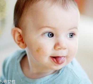 胎記怎么去除？胎記有遺傳的可能