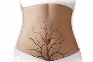 體內(nèi)毒素超標有何表現(xiàn)？五大癥狀須注意