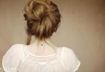 黑痣是怎么形成的？防范黑色毒瘤