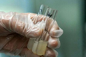 捐精有什么危害？專家稱沒有危害