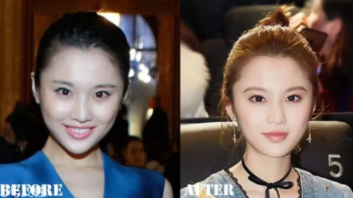 瑯琊榜2張慧雯整容了嗎？換了妝發(fā)美到不認識