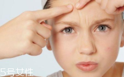 痘痘肌該怎么化妝？這樣化才利于肌膚恢復(fù)