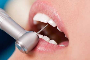 磨牙是因?yàn)槭芰宋?？孩子的心理狀況也會(huì)導(dǎo)致磨牙