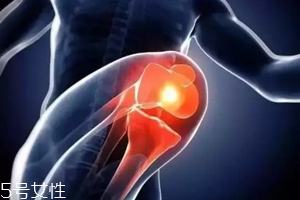 關(guān)節(jié)有響聲是病嗎？?jī)煞N情況區(qū)別對(duì)待