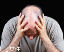脫發(fā)有沒(méi)有治？只要不是禿子就有得治
