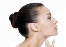 頸紋可以消除嗎？醫(yī)美方法最靠譜