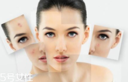 光敏食物真的會(huì)導(dǎo)致變黑嗎？只有敏感皮才要注意