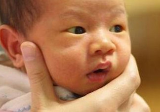 新生兒長(zhǎng)黃疸怎么辦？有些黃疸癥狀媽媽們可別忽視