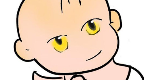 新生兒長(zhǎng)黃疸怎么辦？有些黃疸癥狀媽媽們可別忽視