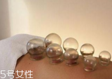 拔火罐引火上身的原因是什么？這4點(diǎn)要注意