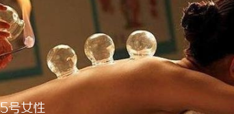 拔火罐引火上身的原因是什么？這4點(diǎn)要注意