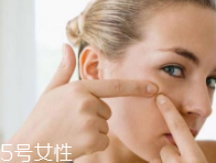 肌膚需要排毒嗎？長痘并不代表排毒