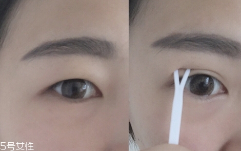 雙眼皮貼一般多少錢(qián)？