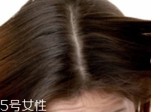 油性頭發(fā)跟什么有關(guān)？離不了這6個原因