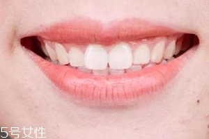 口紅病有哪些癥狀？使用不當(dāng)引發(fā)癌癥