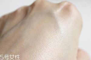 白癜風(fēng)與身體免疫功能有關(guān)系嗎？?jī)烧哧P(guān)系密切