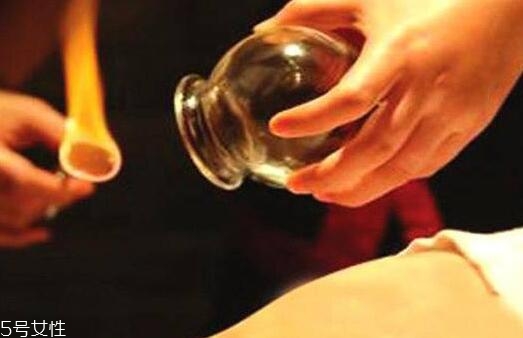 拔罐后身上后背持續(xù)發(fā)癢怎么回事？體內(nèi)風(fēng)邪是主因