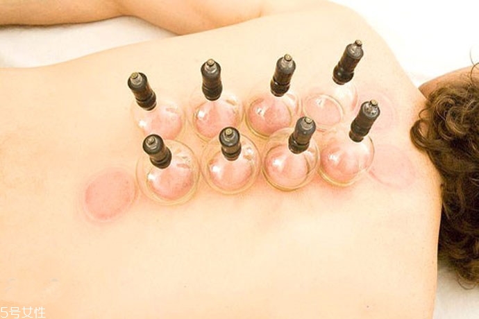 拔罐后身上后背持續(xù)發(fā)癢怎么回事？體內(nèi)風(fēng)邪是主因