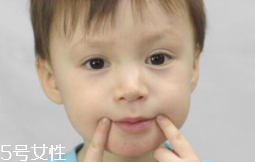 冬天爛嘴角什么原因？有可能營養(yǎng)不良