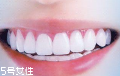 牙線和漱口水是否必要？抑菌護(hù)牙好習(xí)慣