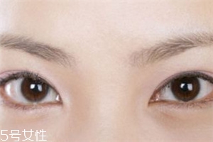 割雙眼皮后怎樣恢復快？女人不能割雙眼皮的時期