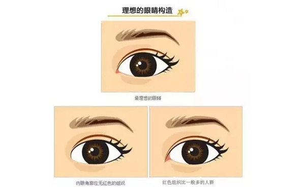 開外眼角和開內(nèi)眼角哪個(gè)好？開眼角有可能會(huì)回縮