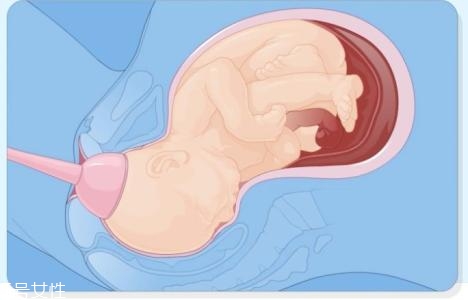 怎樣判斷自己能不能順產 判斷的3個依據