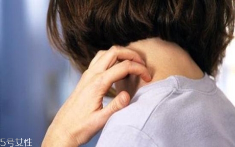 冬天皮膚癢怎么回事 4種原因需警惕 冬天皮膚癢怎么回事 4種原因需警惕