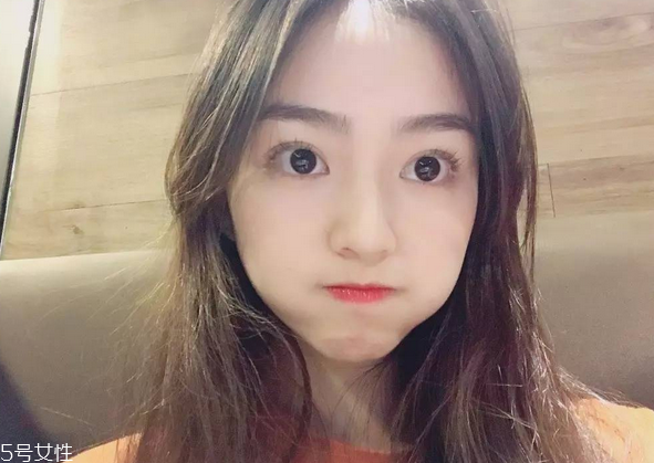 割雙眼皮要注意什么？割雙眼皮充血是正常現(xiàn)象