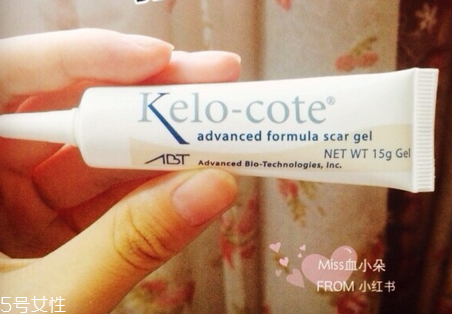 割雙眼皮眼睛腫怎么辦？疤克可以預(yù)防疤痕增生