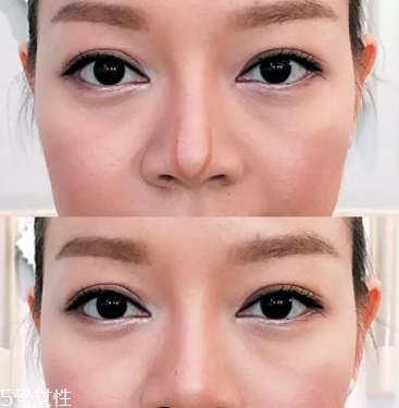 眉粉可以當(dāng)鼻影用嗎？眉粉這樣畫鼻影