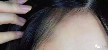 眉粉可以當(dāng)發(fā)際線粉嗎？解救高發(fā)際線的技巧