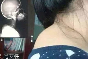 富貴包是什么??？姿態(tài)優(yōu)美少犯病