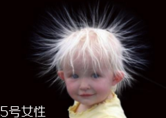 少年白什么原因？焦慮緊張會得病