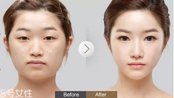 蕾絲雙眼皮貼好用嗎？蕾絲雙眼皮貼教程