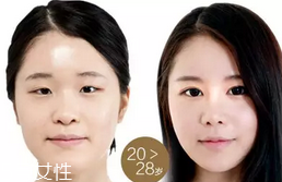 蕾絲雙眼皮貼好用嗎？蕾絲雙眼皮貼教程