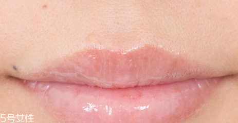 蘭芝唇膜吃進(jìn)去怎么辦？擁有水嫩嘴唇