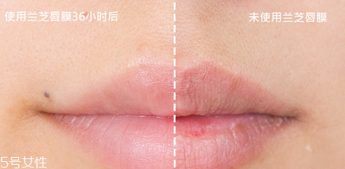 蘭芝唇膜吃進(jìn)去怎么辦？擁有水嫩嘴唇