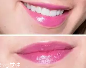 唇釉適合哪些人用？唇紋深的人