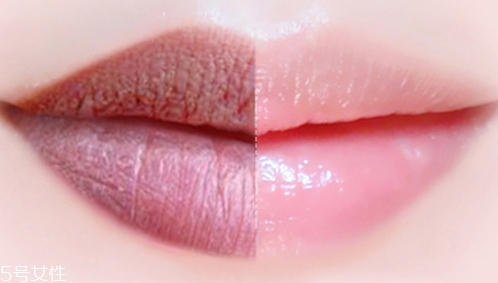 唇膏可以祛痘嗎？小心致痘風(fēng)險(xiǎn)