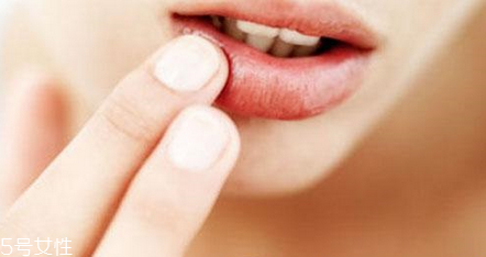 蘭芝唇膜孕婦能用嗎？起皮嘴唇的福音