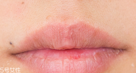 蘭芝唇膜小孩能用嗎？蘭芝唇膜正確使用方法